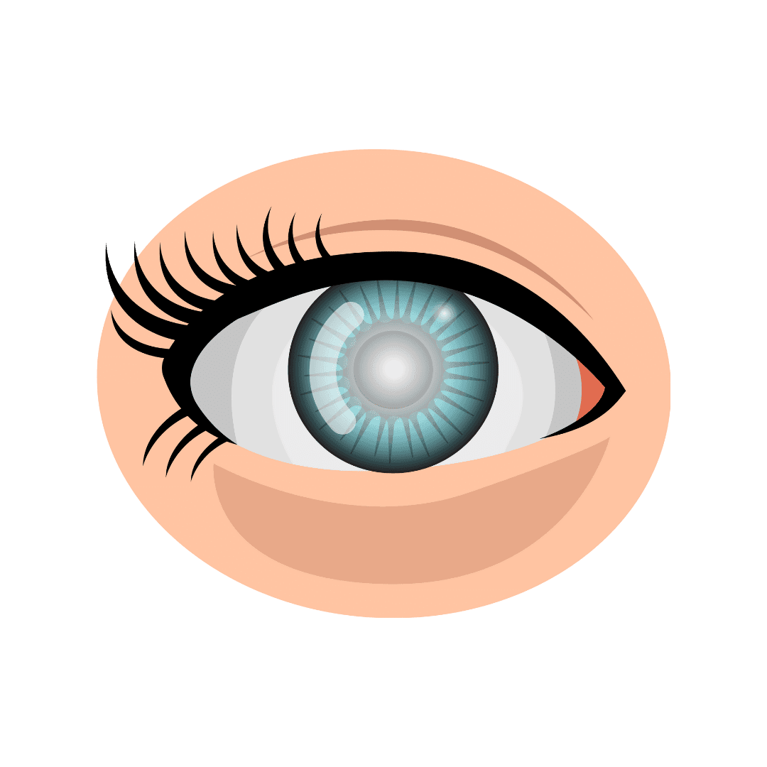 Cataract